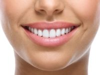 sonrisa
