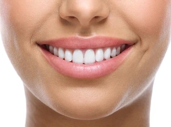 sonrisa