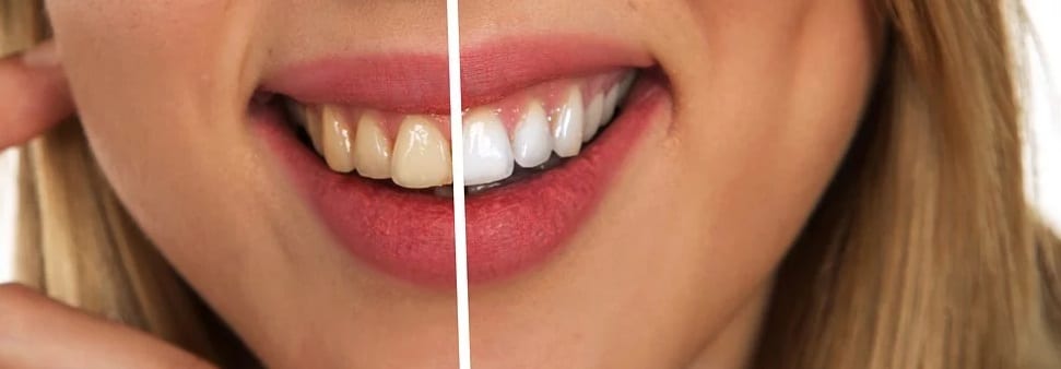 color dientes